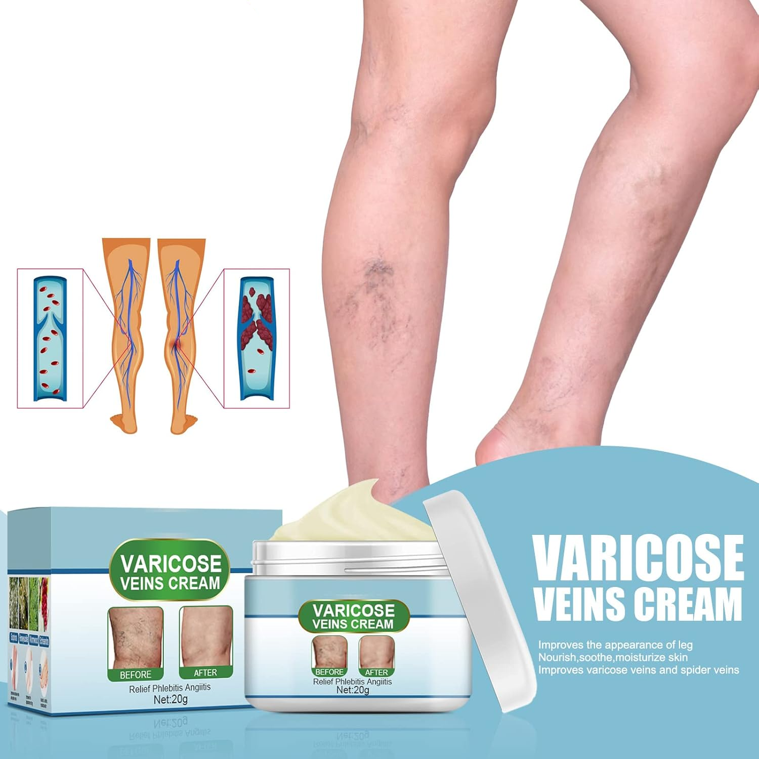 50% RABATT | VeinEase™ | Glättet und Beruhigt Müde Beine