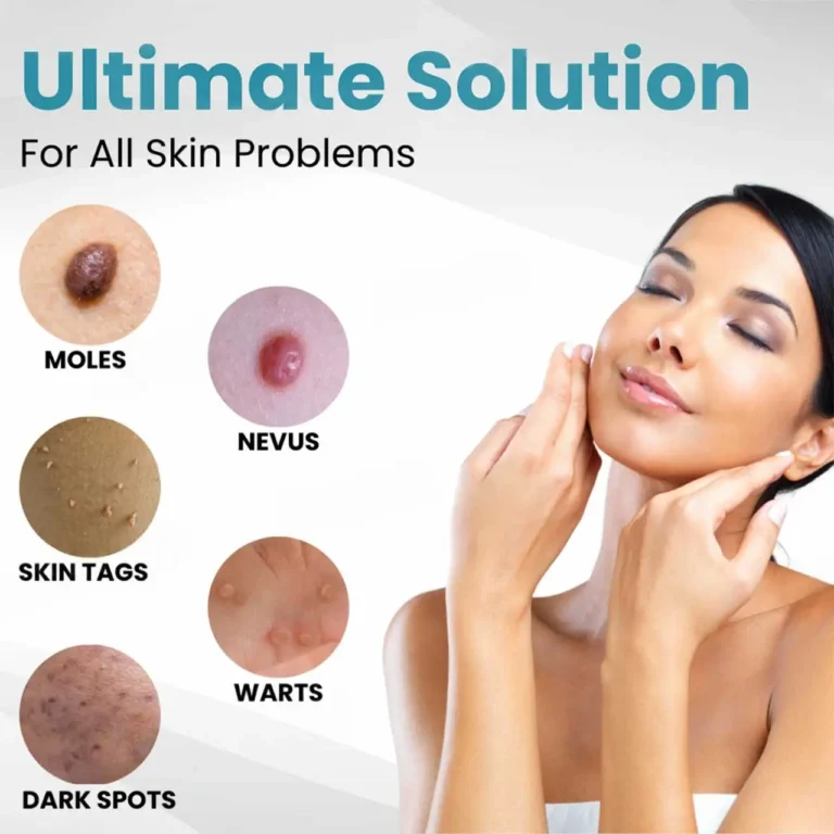 50% RABATT | SkinRenew™ | Sichere, Sanfte und Wirksame Hautpflege