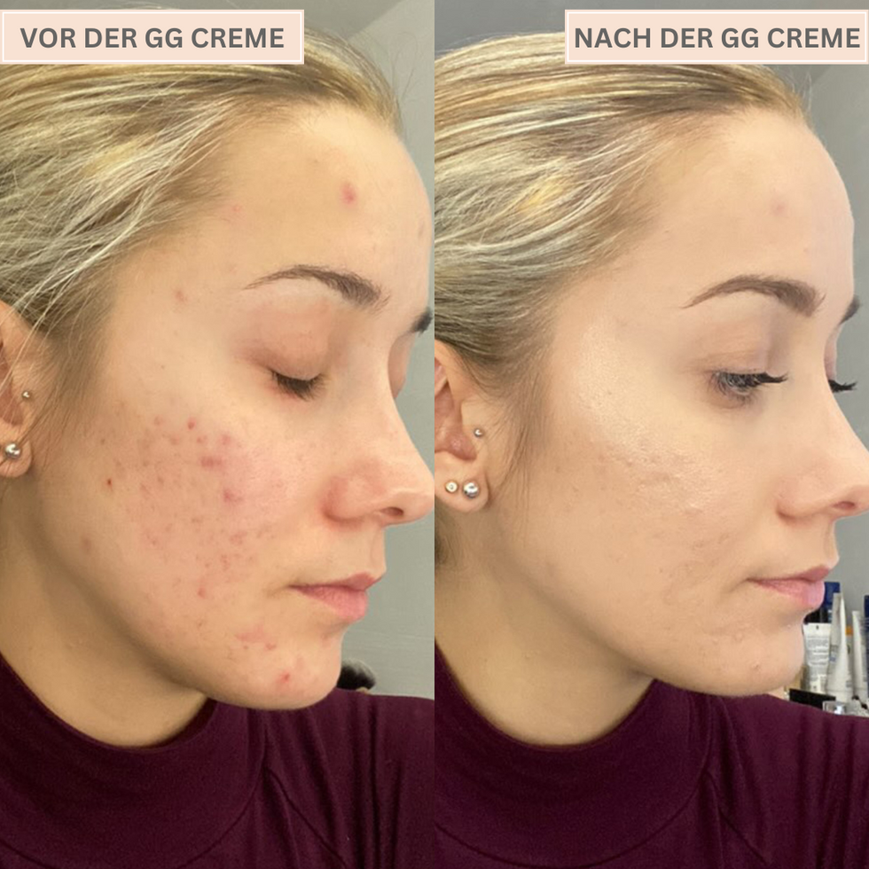 Glowelle™ | Strahlender Teint, ganz ohne Filter