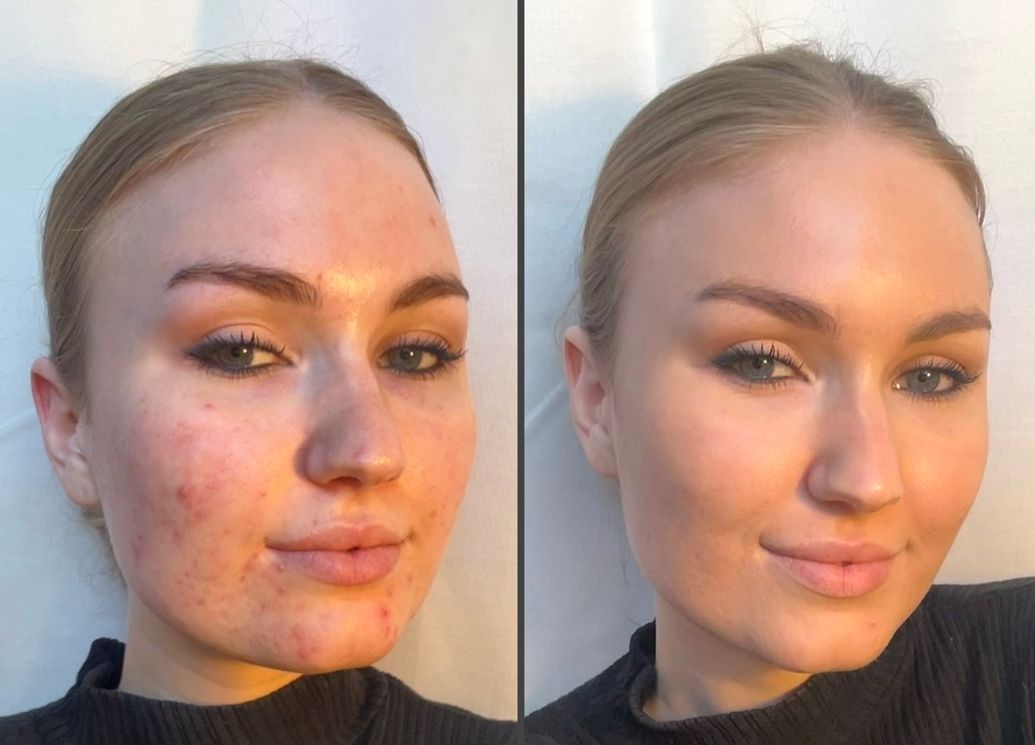 Glowelle™ | Strahlender Teint, ganz ohne Filter