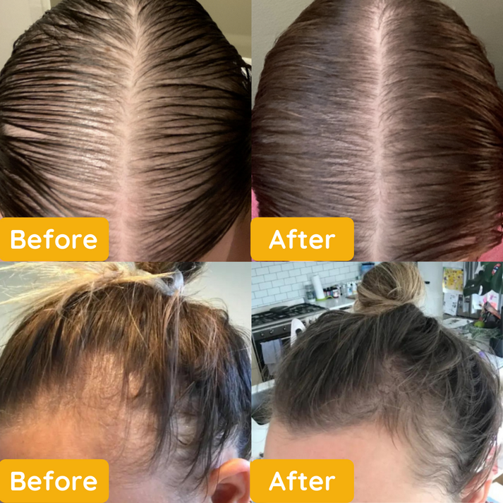1+1 Gratis | Eelhoe Veghair - Natürliches veganes Haarwachsolie