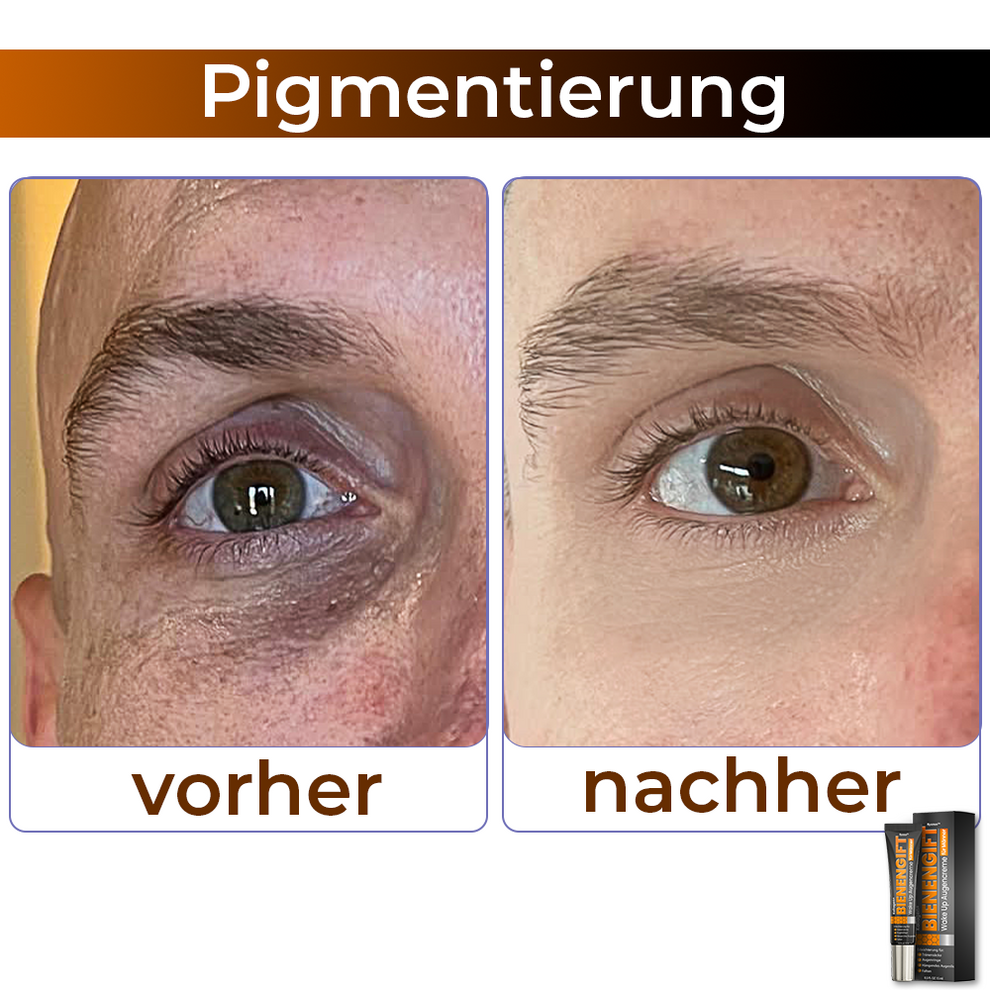 StingLift™ | Kollagen+ Bienengift Augencreme für Männer