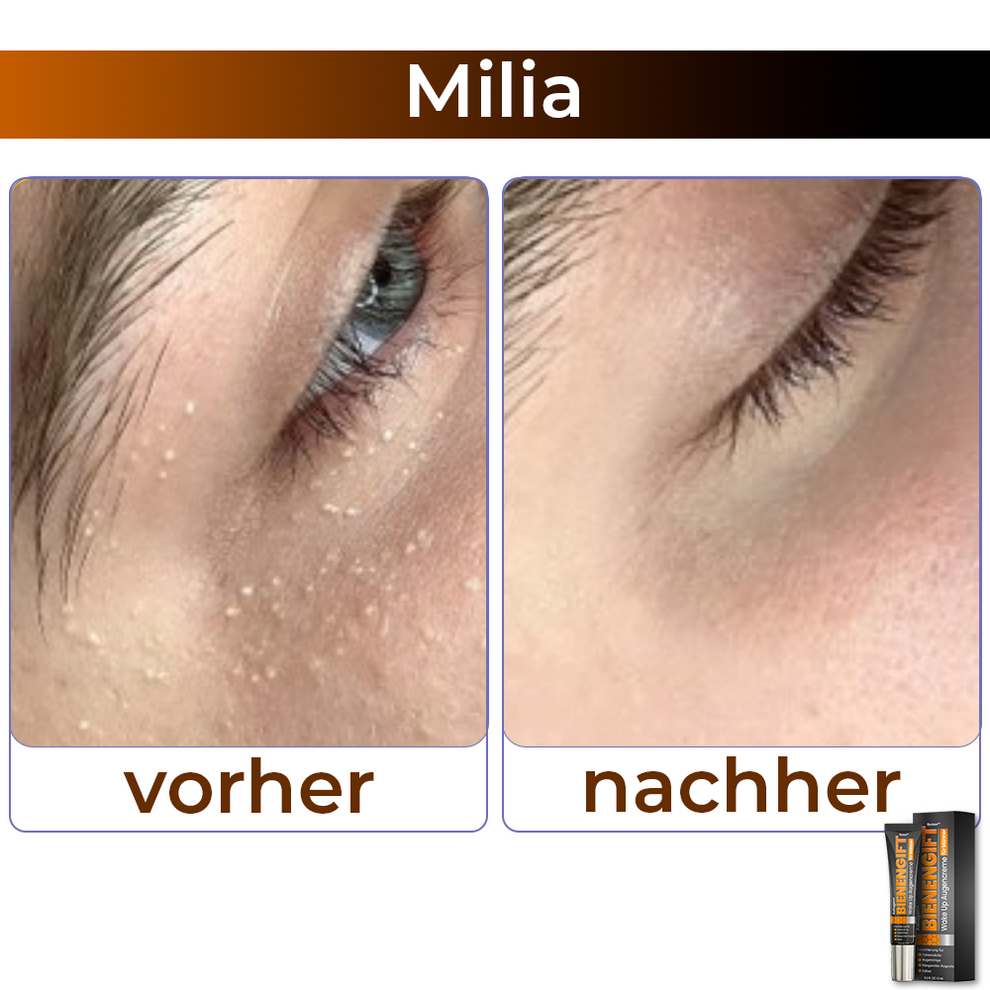 StingLift™ | Kollagen+ Bienengift Augencreme für Männer