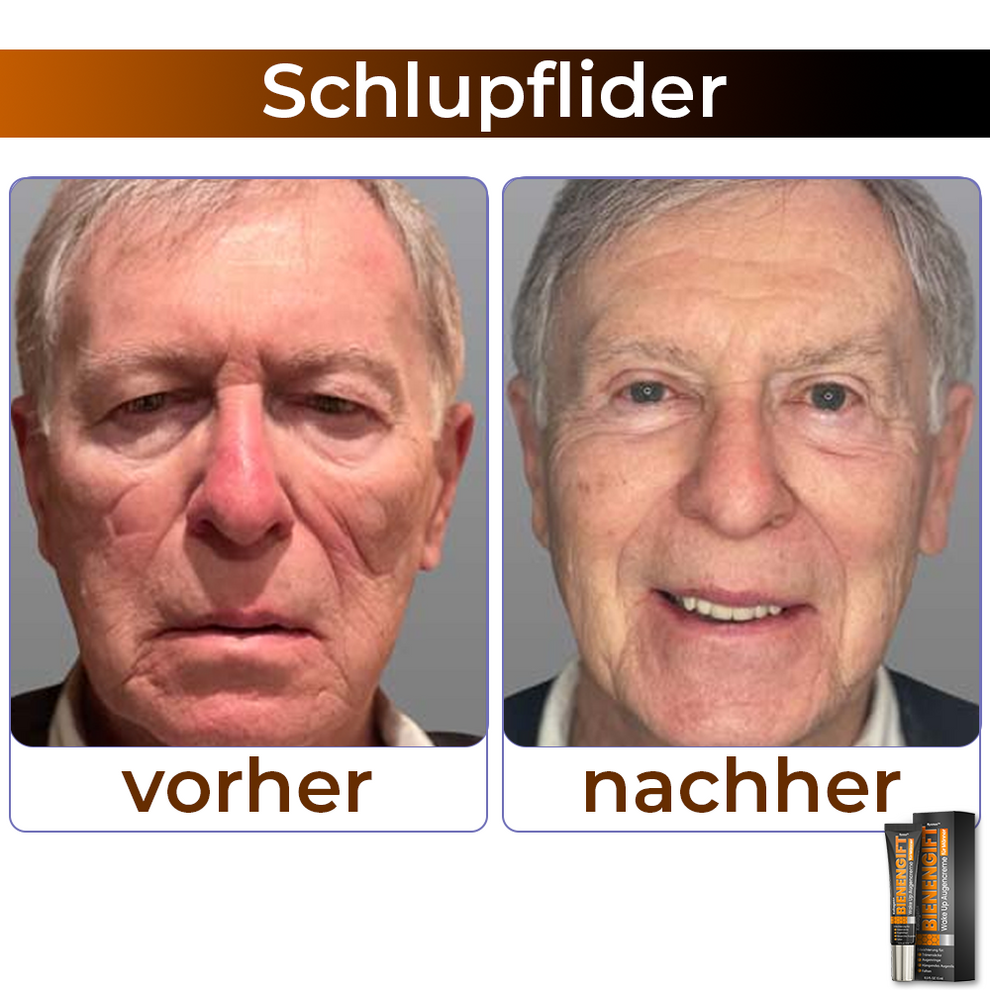 StingLift™ | Kollagen+ Bienengift Augencreme für Männer