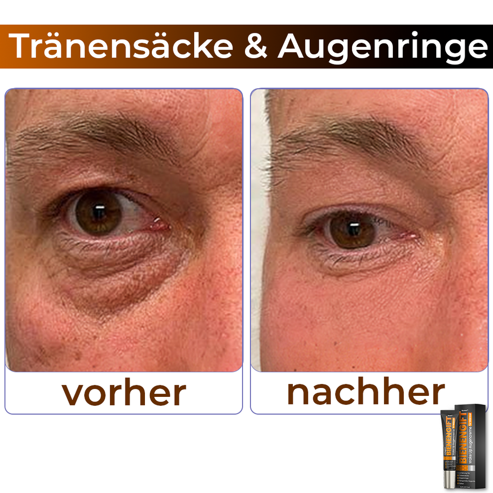 StingLift™ | Kollagen+ Bienengift Augencreme für Männer