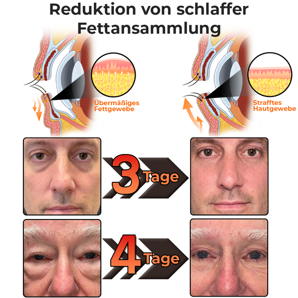 StingLift™ | Kollagen+ Bienengift Augencreme für Männer