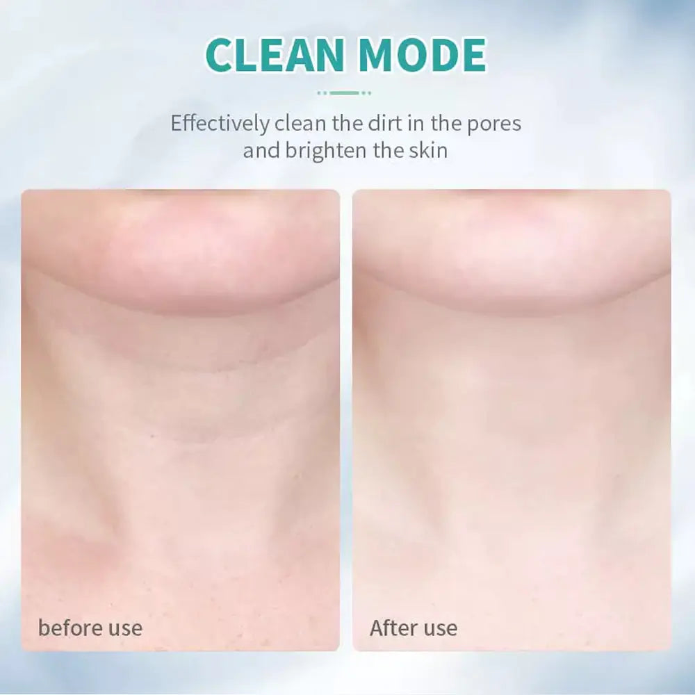 50% RABATT | SmoothPro® | Gesichts- und Hals-Sculptor