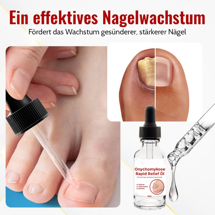 1+1 GRATIS | FungiFix™ | Onychomykose Rapid Relief Öl