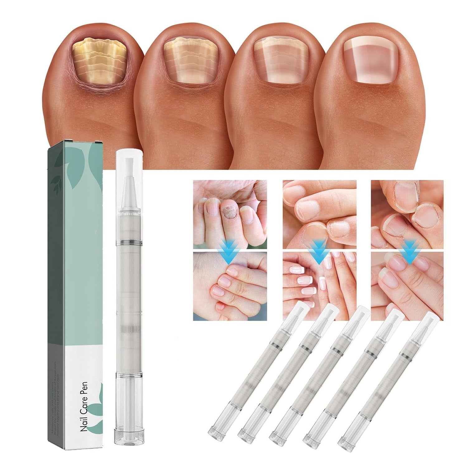 1 + 1 GRATIS | KeratiGlow™ | Bio-Nagelpflegestift