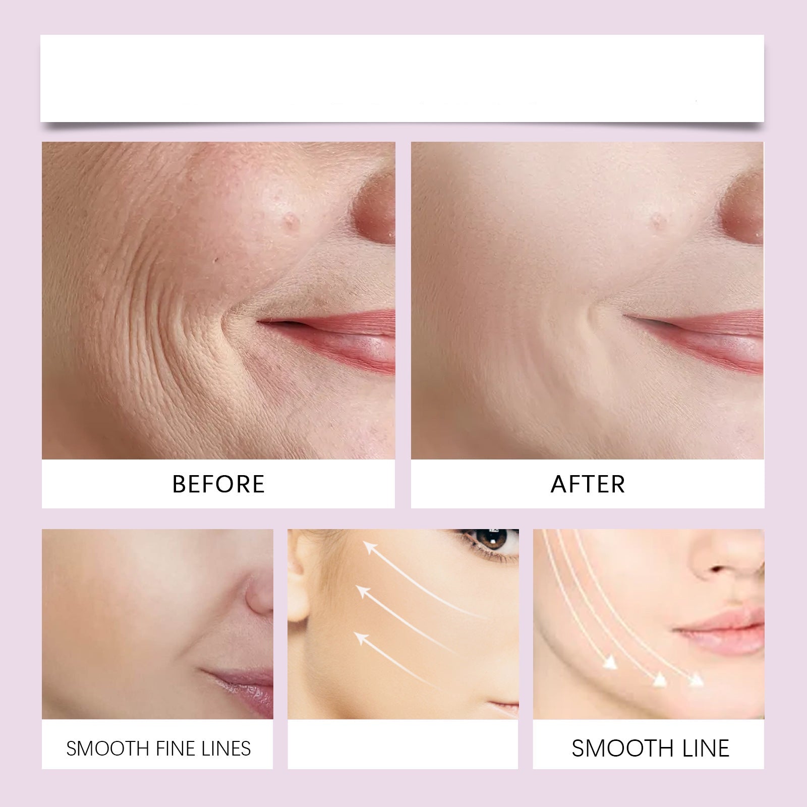 1+1 Gratis | BeauLift™ - Unsichtbares Gesichtsstraffungsband