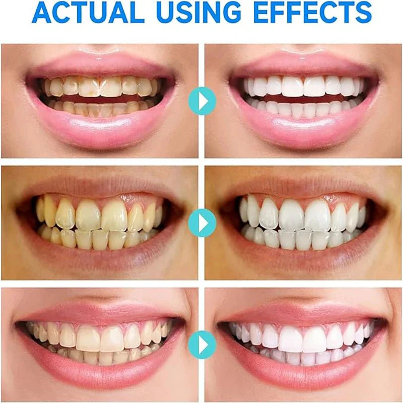 1+1 GRATIS | PureTeeth™ | Niacinamid Aufhellende Zahnpasta