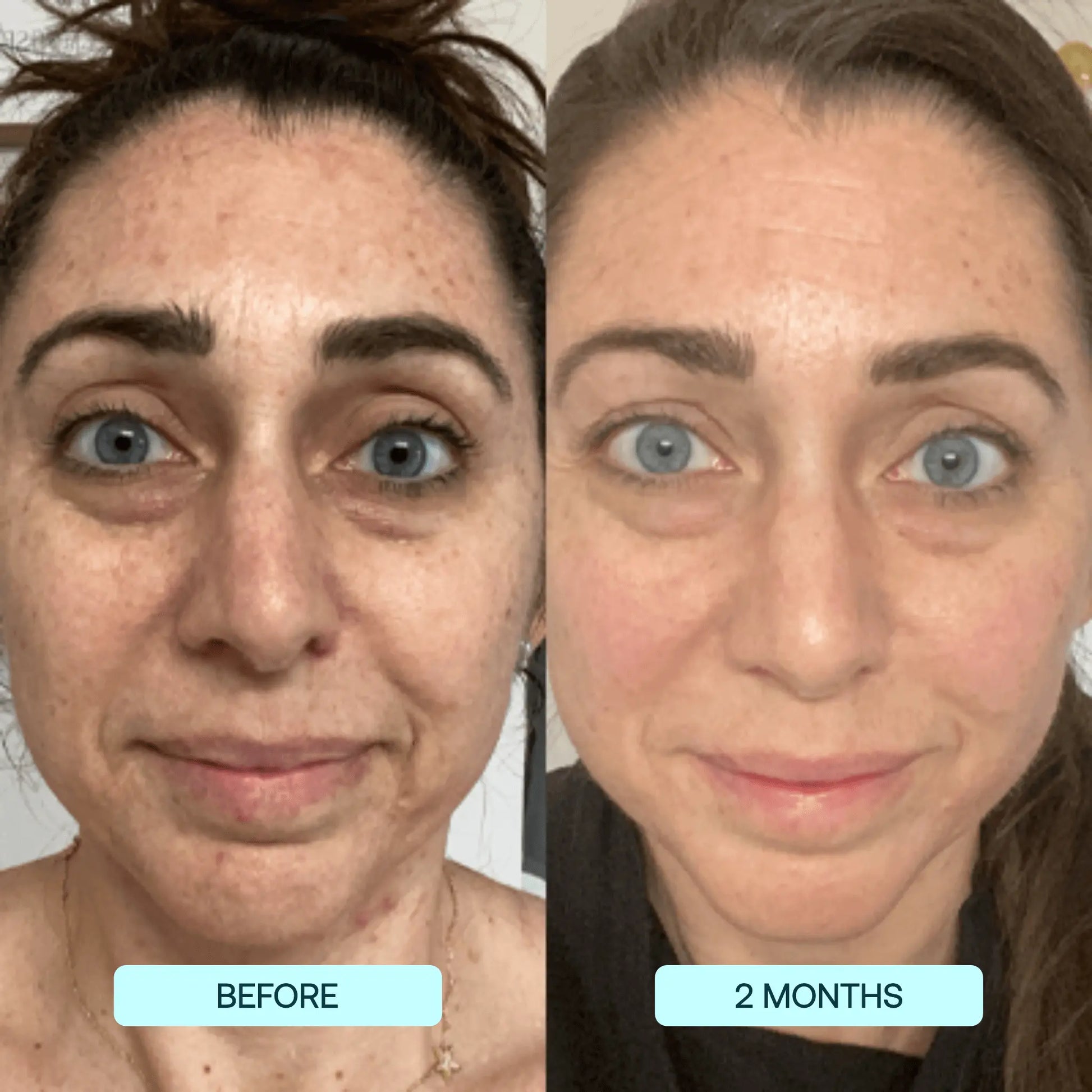 1+1 GRATIS | GlowSkin™ Sofort glattere Haut