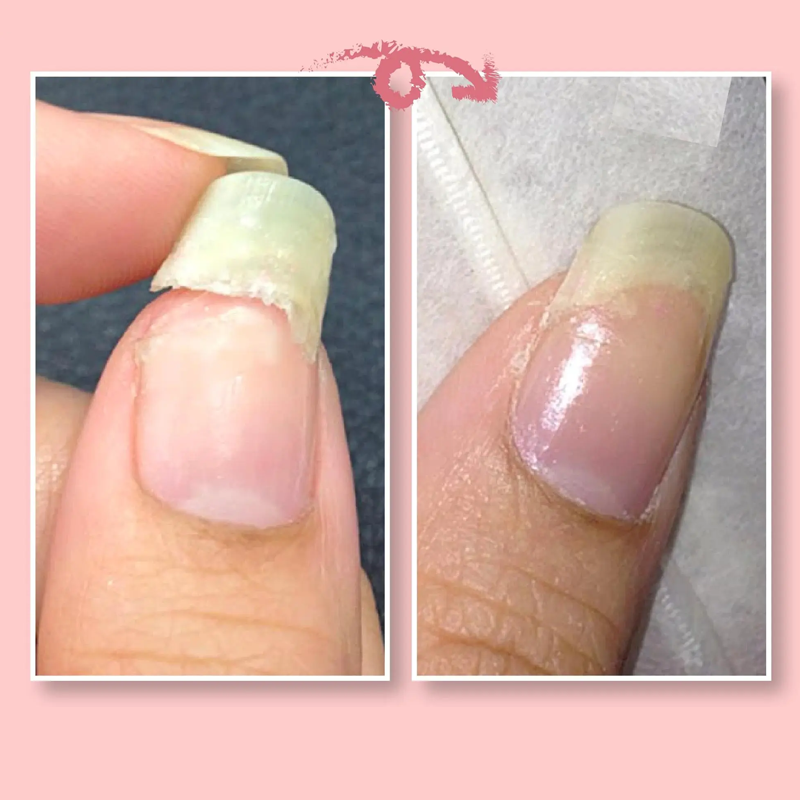 1+1 GRATIS | NailGuard | Schutzgel für die Nagelreparatur