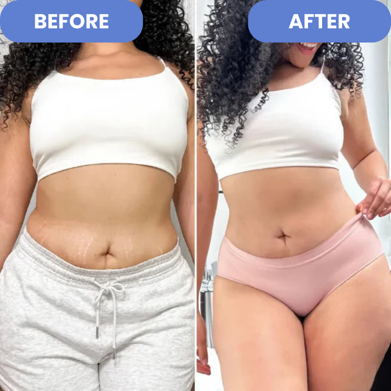 50% RABATT | Cellurelle™ | Anti-Cellulite-Entferner