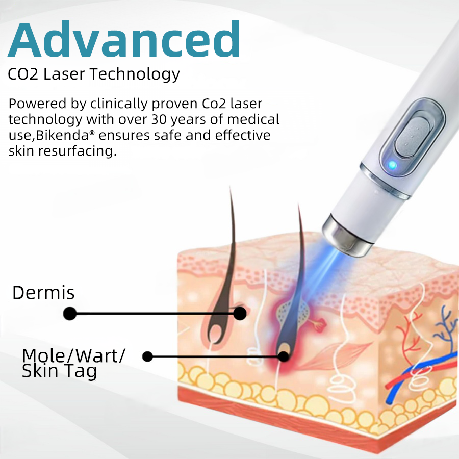 DermaZap® | CO₂-Laser-Entfernungswerkzeug