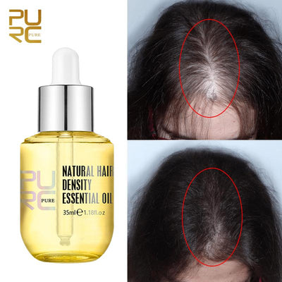 50% RABATT | PurcPure™ | Haarwachstum Ingwer Essenz Öl