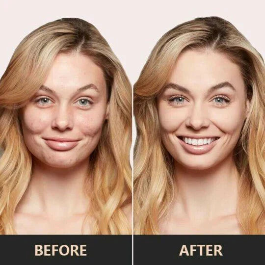 1+1 GRATIS | Dermahealix® | Intensiv nährende Creme für reife Haut