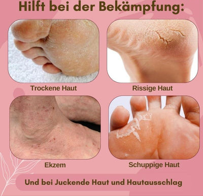 1+1 GRATIS | Pediquell™ | Sofortige Fußpflege