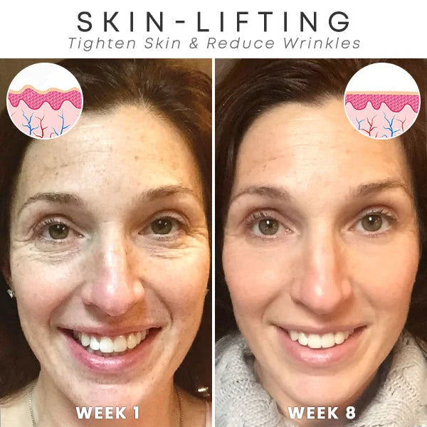 1+1 GRATIS | GlowTox™ | Glatte, jugendliche Haut mit Botox Anti-Aging Serum