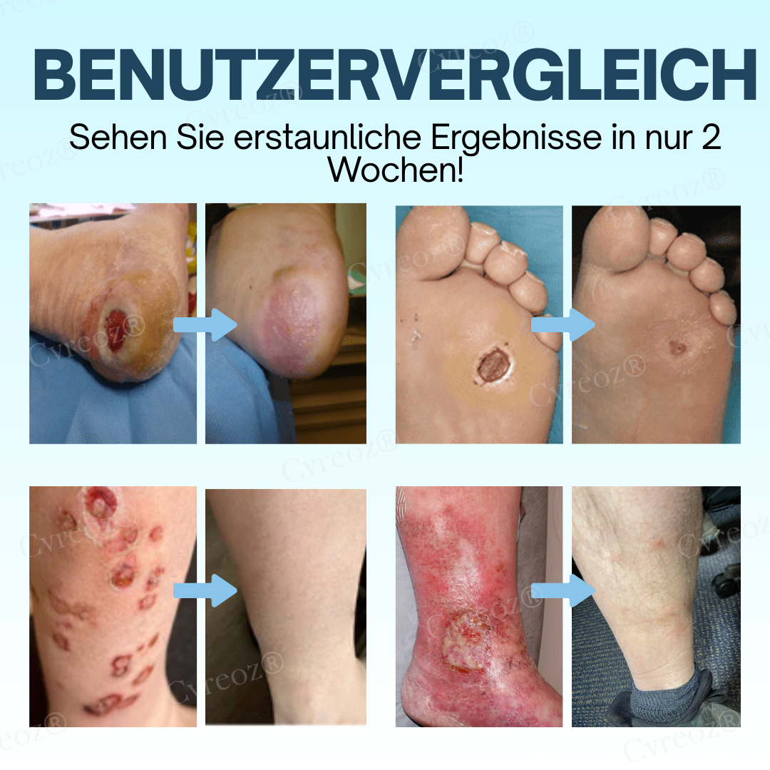Glycure™ | Feuchtigkeitsspendend und schützend