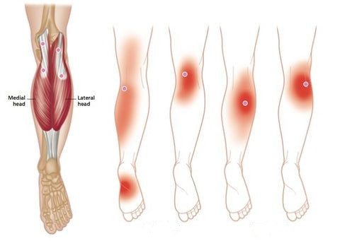 50% RABATT | ThermaKnee™ | Selbstheizende Kniebandage: schnelle Schmerzlinderung