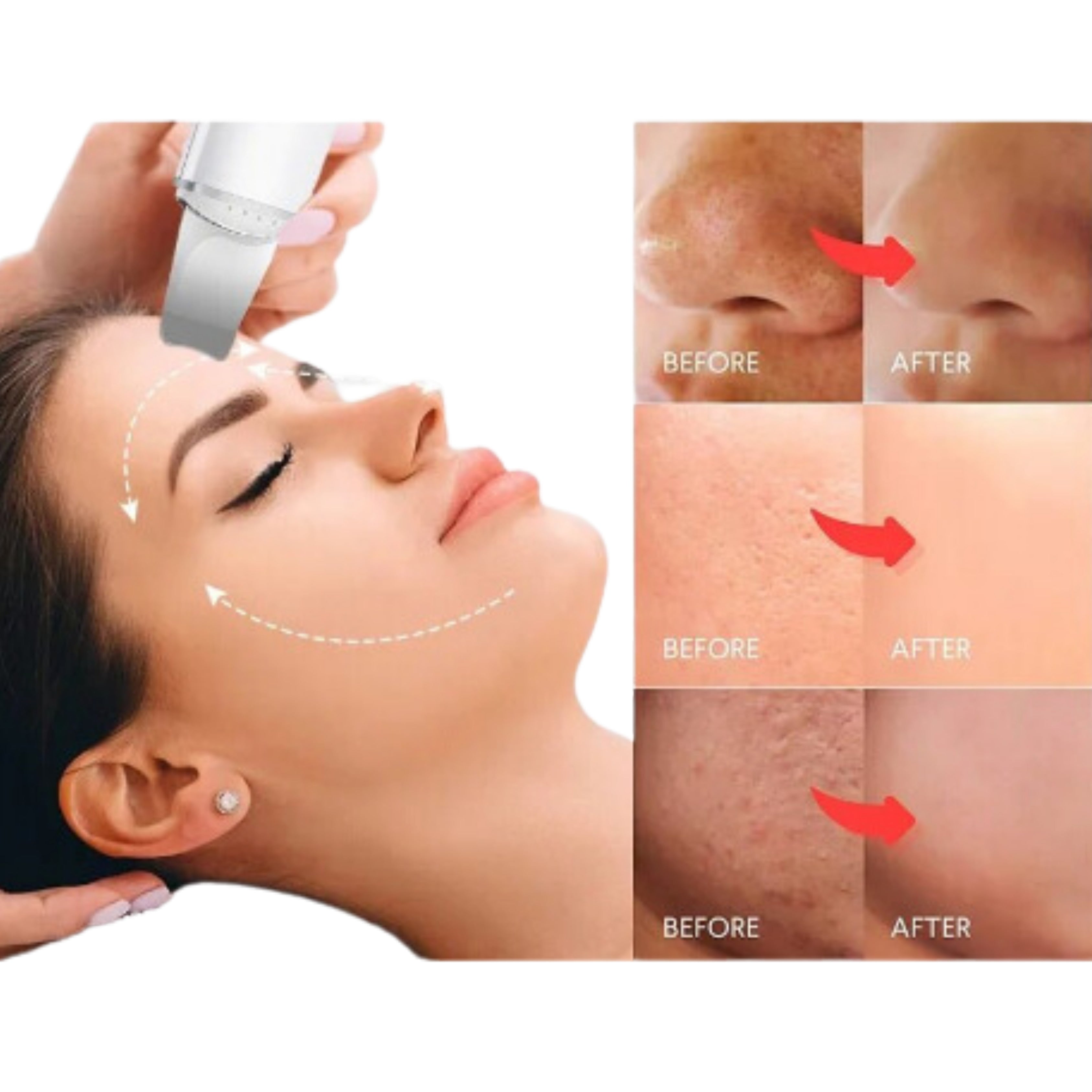 DermaLift™ | Porentiefe Reinigung