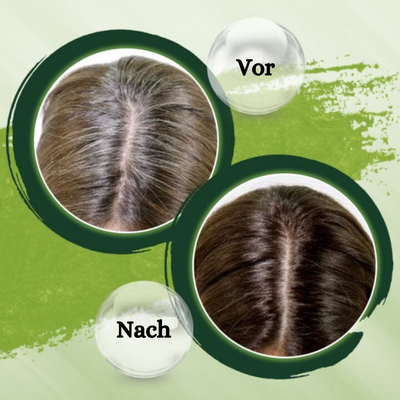 1+1 GRATIS | GingerBar™ | Haarverdunkelungs-Shampoo Bar