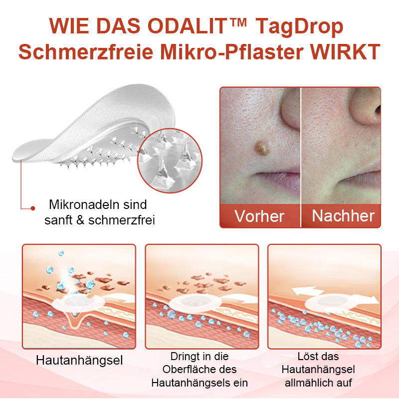1+1 GRATIS | DermiClear™ Schmerzfreie Entfernung von Hautanhängseln