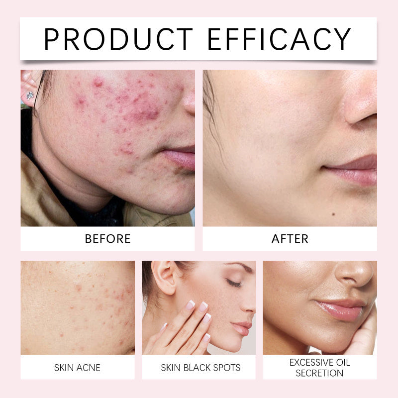 1+1 GRATIS | GlowMask™ Sanfte Reinigung