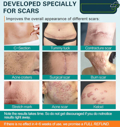 50% RABATT | Scaravie™ | DermaSilk Narbenspray