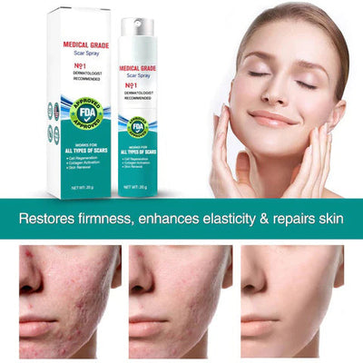 50% RABATT | Scaravie™ | DermaSilk Narbenspray
