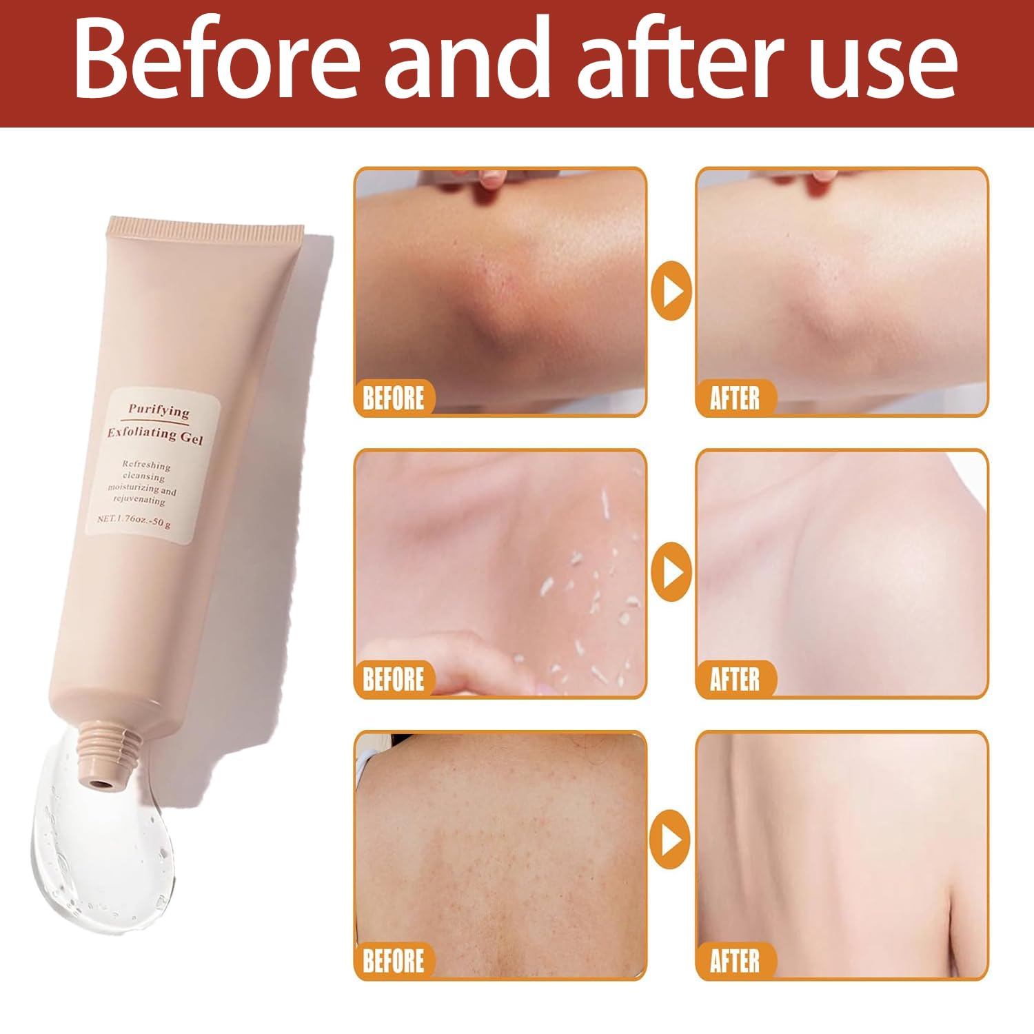 GlowFlash® | Schnell wirksames Peeling-Gel
