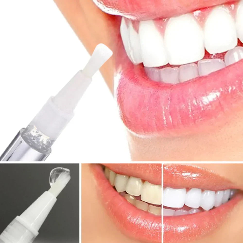 Frau verwendet Diamond Smile Zahnaufhellungsstift für strahlend weiße Zähne – einfach anzuwenden und effektiv gegen Verfärbungen