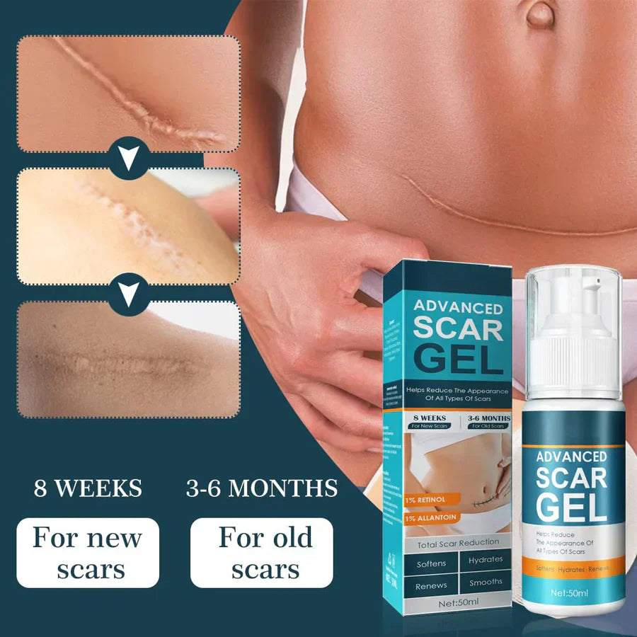 1+1 GRATIS | ScarGel™ | Narben verblassen schön.
