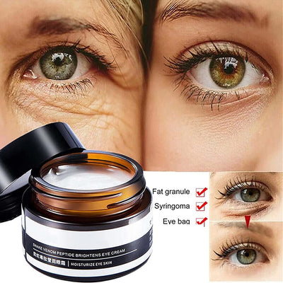 1+1 GRATIS | EyeRejuv™ | Faltenentfernende Augencreme!