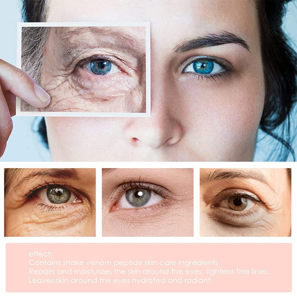 1+1 GRATIS | EyeRejuv™ | Faltenentfernende Augencreme!