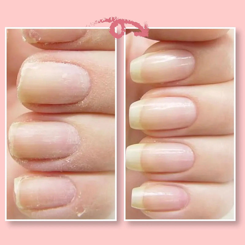 1+1 GRATIS | NailGuard | Schutzgel für die Nagelreparatur