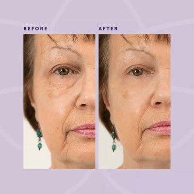 1+1 Gratis | MiracleEye™ | Anti-Falten-Augencreme mit straffender Wirkung