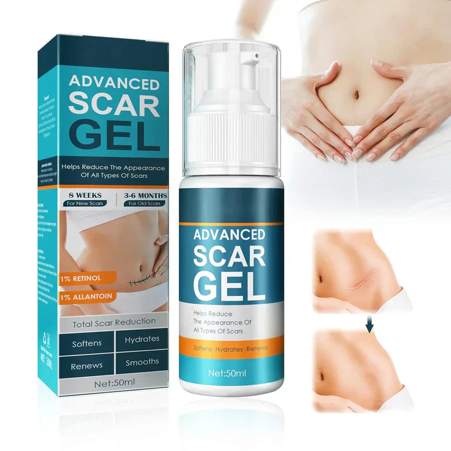 1+1 GRATIS | ScarGel™ | Narben verblassen schön.