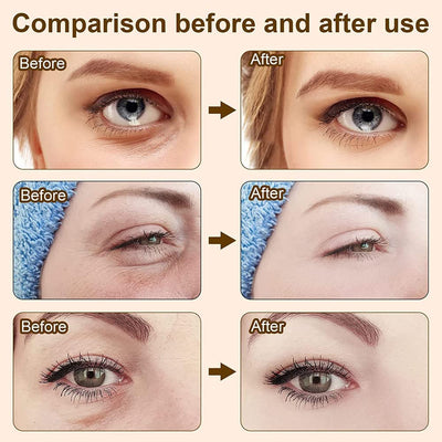 1+1 GRATIS | EyeRejuv™ | Faltenentfernende Augencreme!