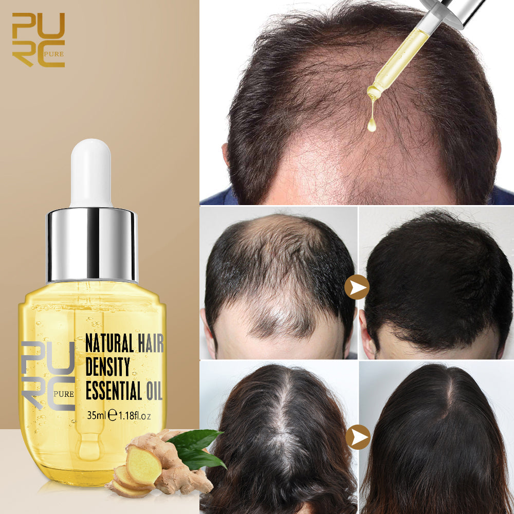 1+1 GRATIS | PurcPure™ | Haarwachstum Ingwer Essenz Öl