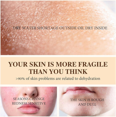 50% RABATT | SkinHaven™ | Enthüllen Sie das Geheimnis seidenweicher Haut von Kopf bis Fuß!