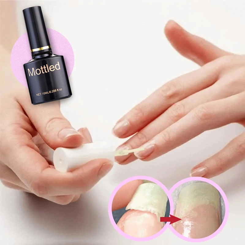 1+1 GRATIS | NailGuard | Schutzgel für die Nagelreparatur