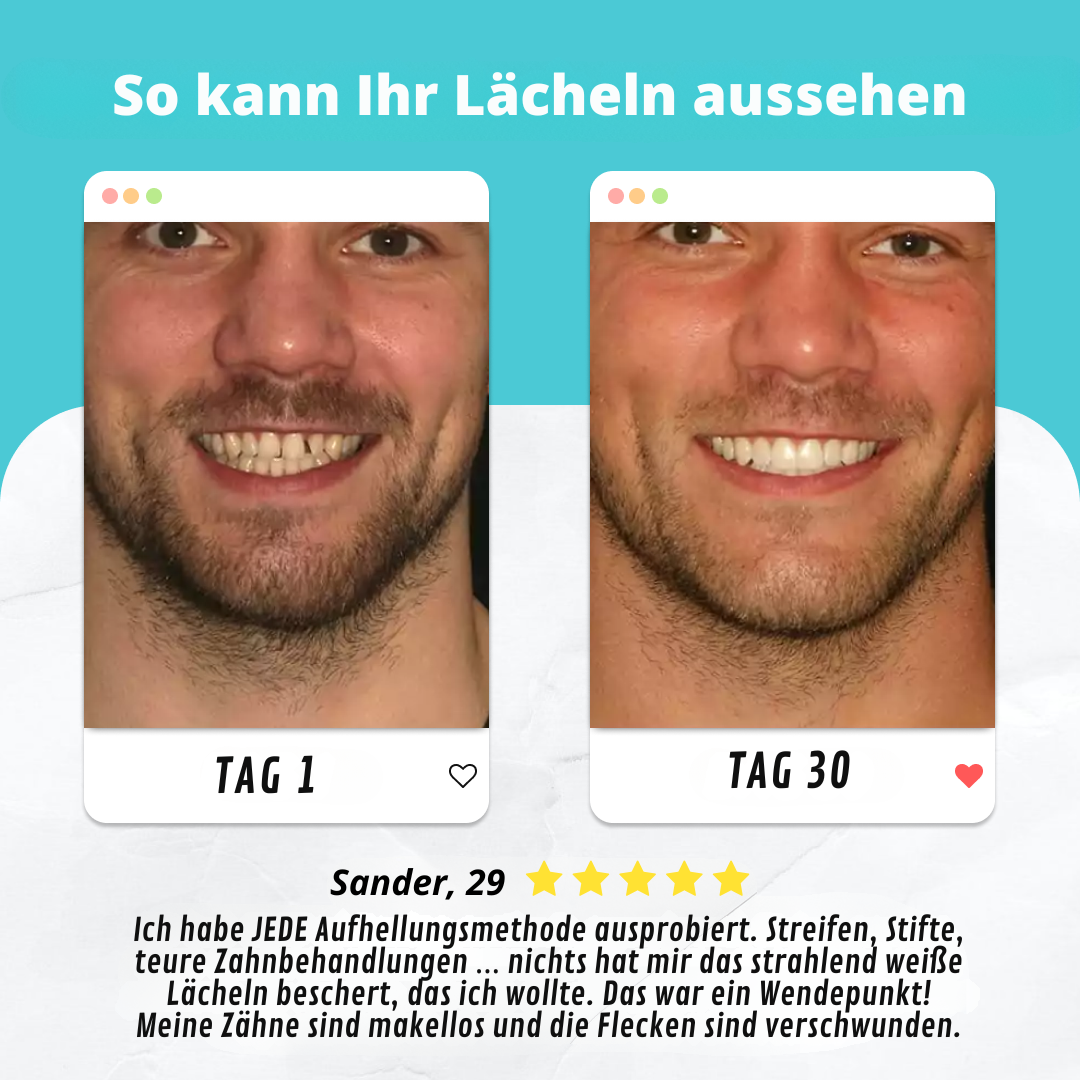 GlowBrush™ | Die automatische Zahnbürste