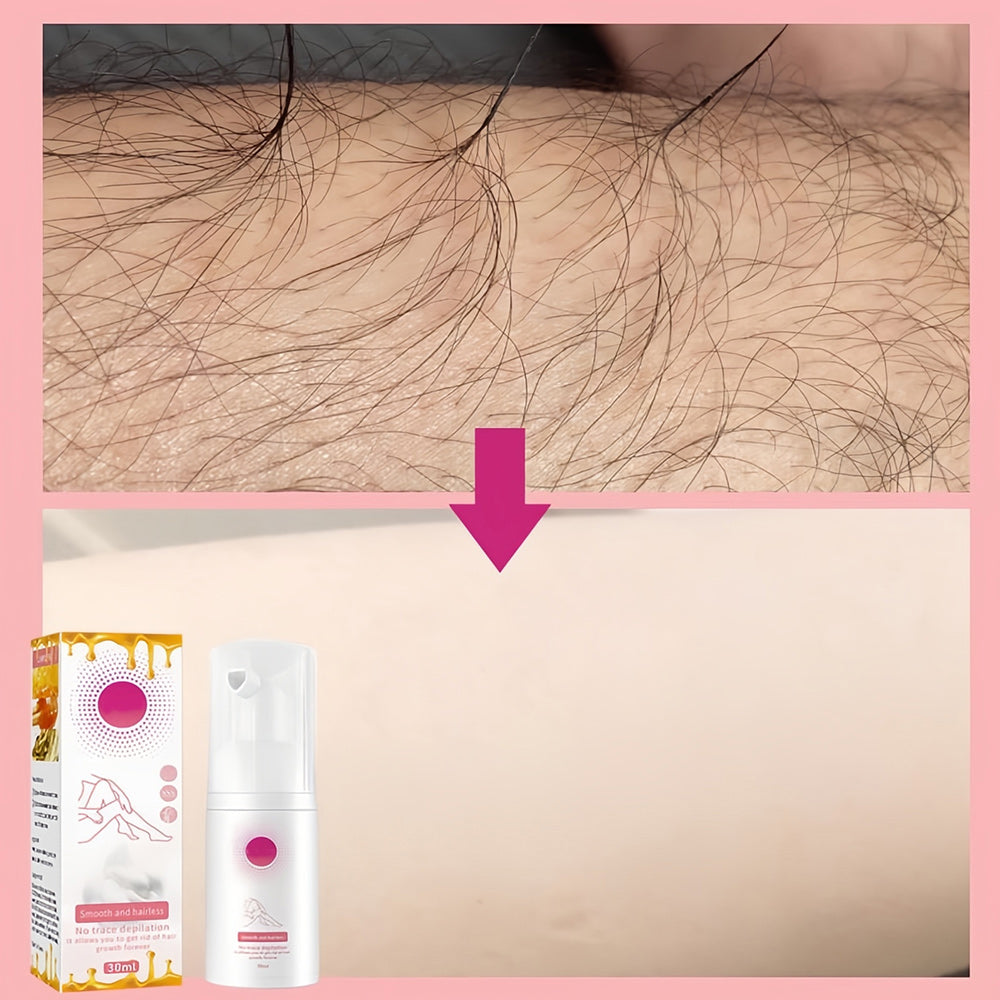 1+1 GRATIS | Honey Mousse Hair Removal Spray™ | Für eine makellose und haarfreie Haut!