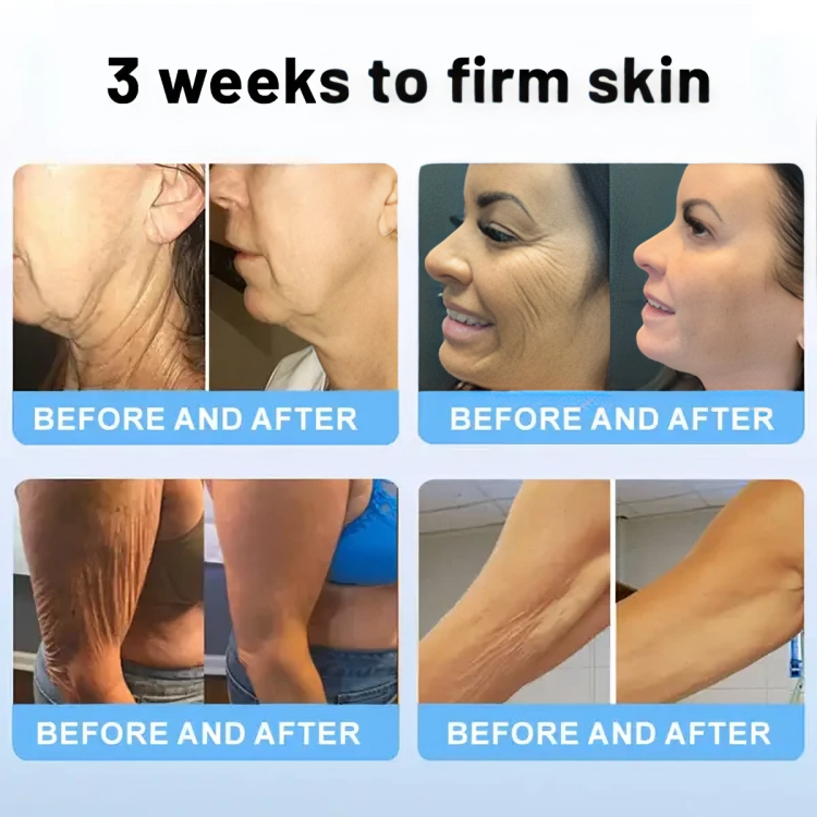 1 + 1 GRATIS | GlowFirm™ | Ihr Geheimnis für straffere, elastischere Haut!