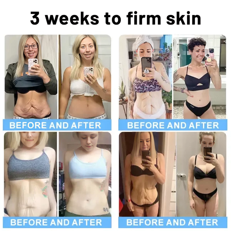 1 + 1 GRATIS | GlowFirm™ | Ihr Geheimnis für straffere, elastischere Haut!