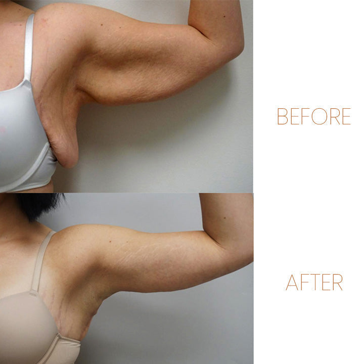 MagneticTherapy™ | Fettverbrennung leicht und elegant gemacht