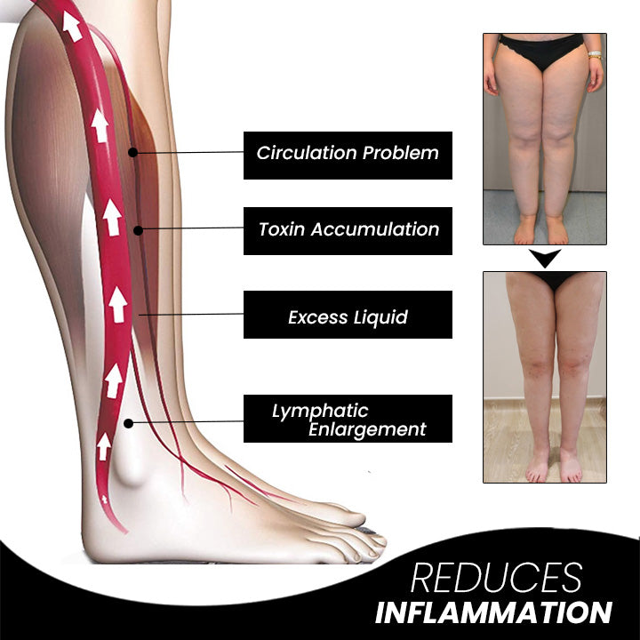 MagneticTherapy™ | Fettverbrennung leicht und elegant gemacht