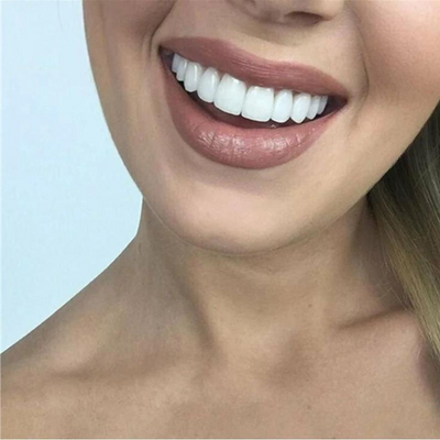 1+1 GRATIS | SnapBright™ | Sofortiges Lächeln mit natürlich aussehenden Veneers
